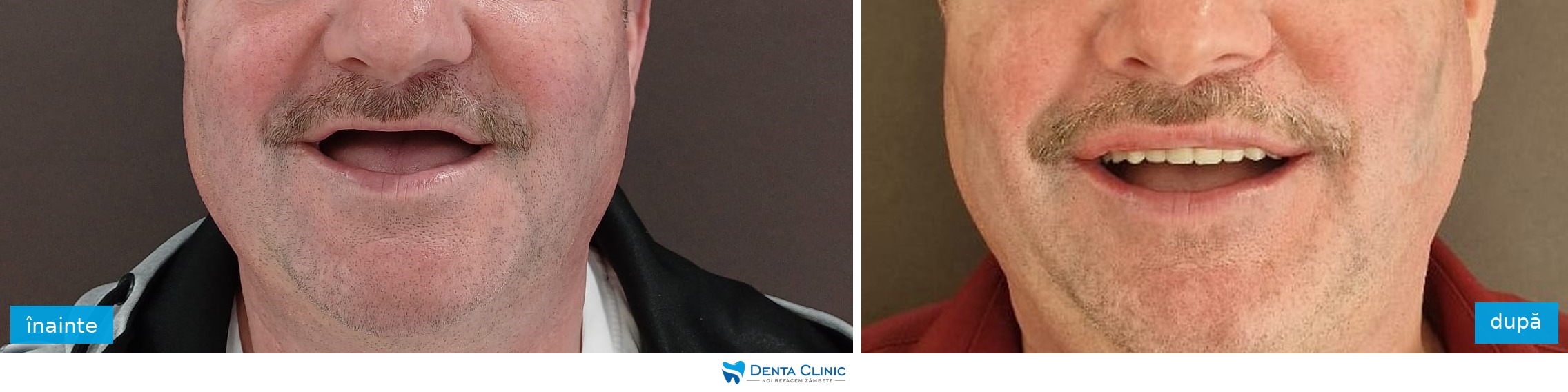 Transformare dentară 10