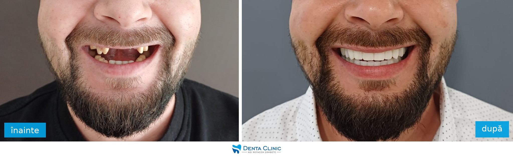 Transformare dentară 7